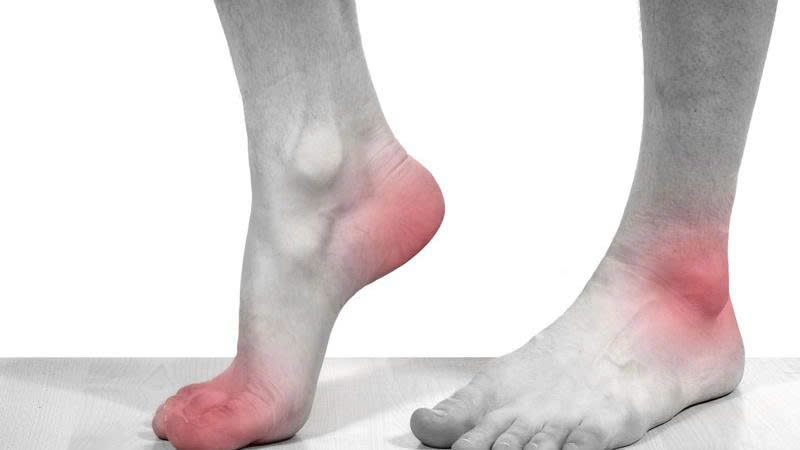 Bệnh gout thường đi kèm với nhiều khuyến cáo về ăn uống